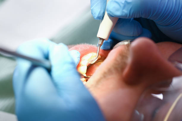 Best Broken or Cracked Tooth Emergency Dentist in Abilene, TX